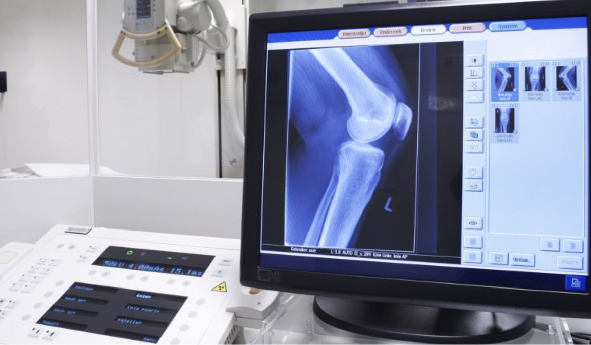 Blog Informativo Valadéz Radiólogos Guanajuato